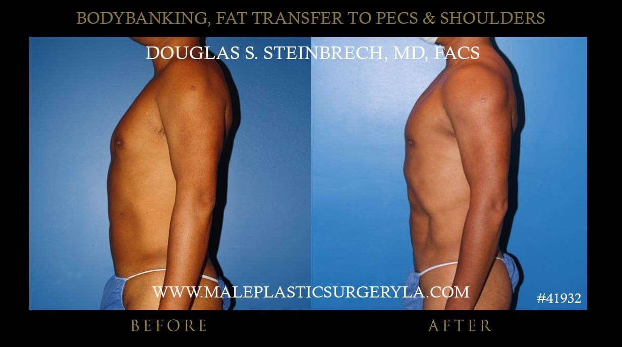 Traps After Shoulders At Eric Lemmon Blog