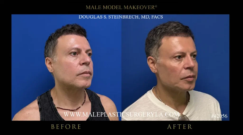 42056-male-model-makeover-315-deg-la