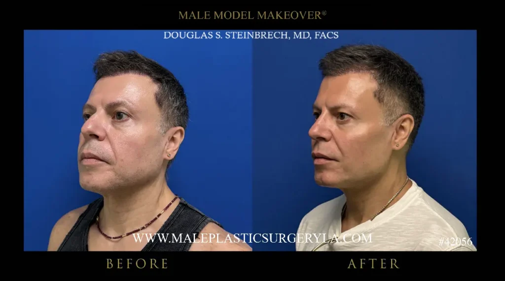 42056-male-model-makeover-45-deg-la