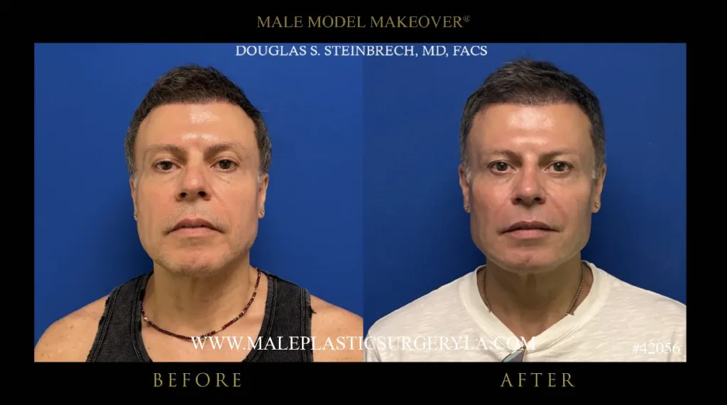 42056-male-model-makeover-frontal-la