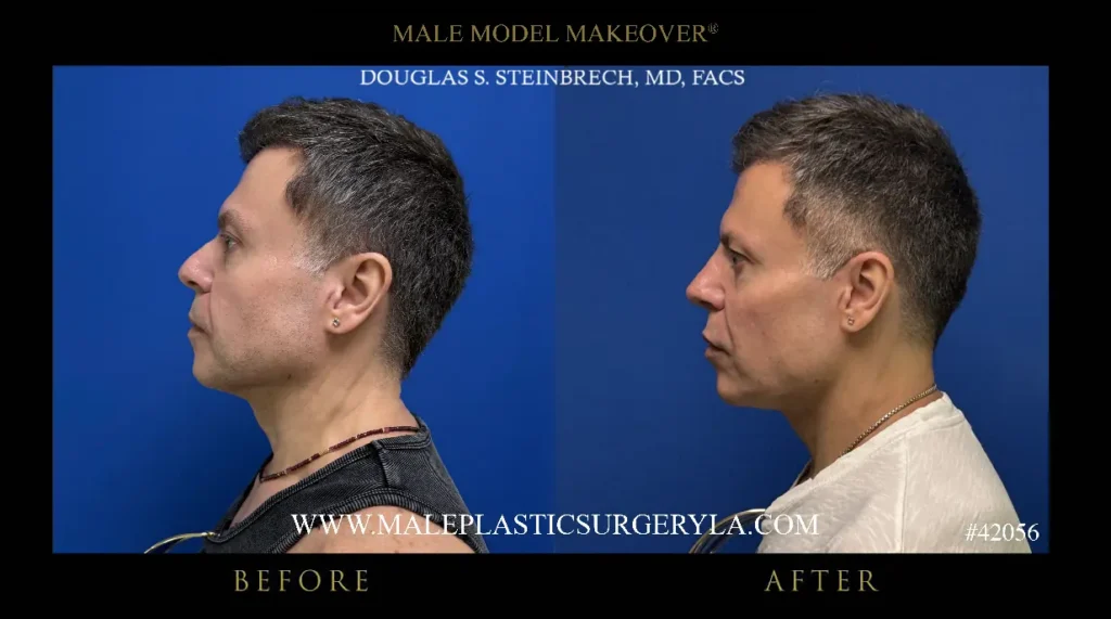 42056-male-model-makeover-left-side-la