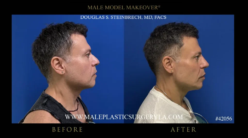 42056-male-model-makeover-right-side-la