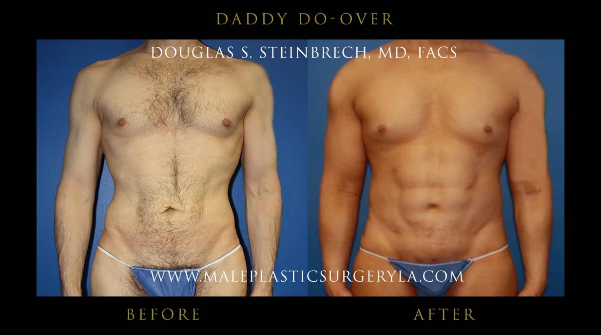 Daddy Do Over - Before & After Photos