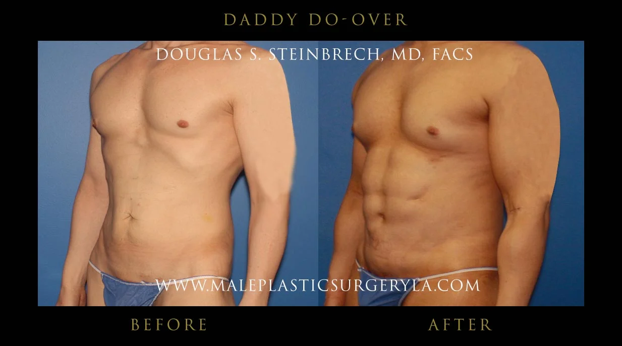 Daddy Do Over - Before & After Photos