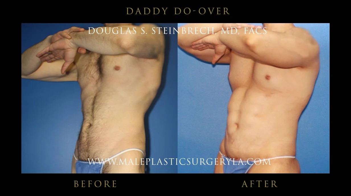 Daddy Do Over - Before & After Photos