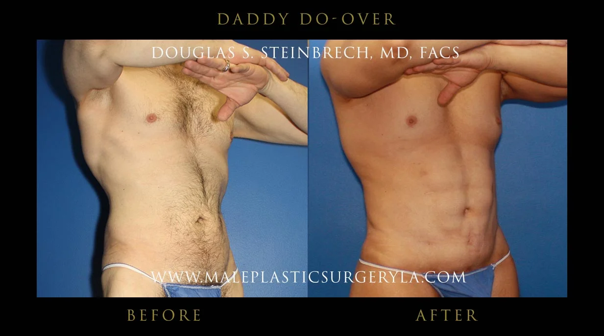 Daddy Do Over - Before & After Photos