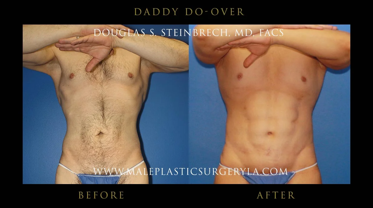 Daddy Do Over - Before & After Photos