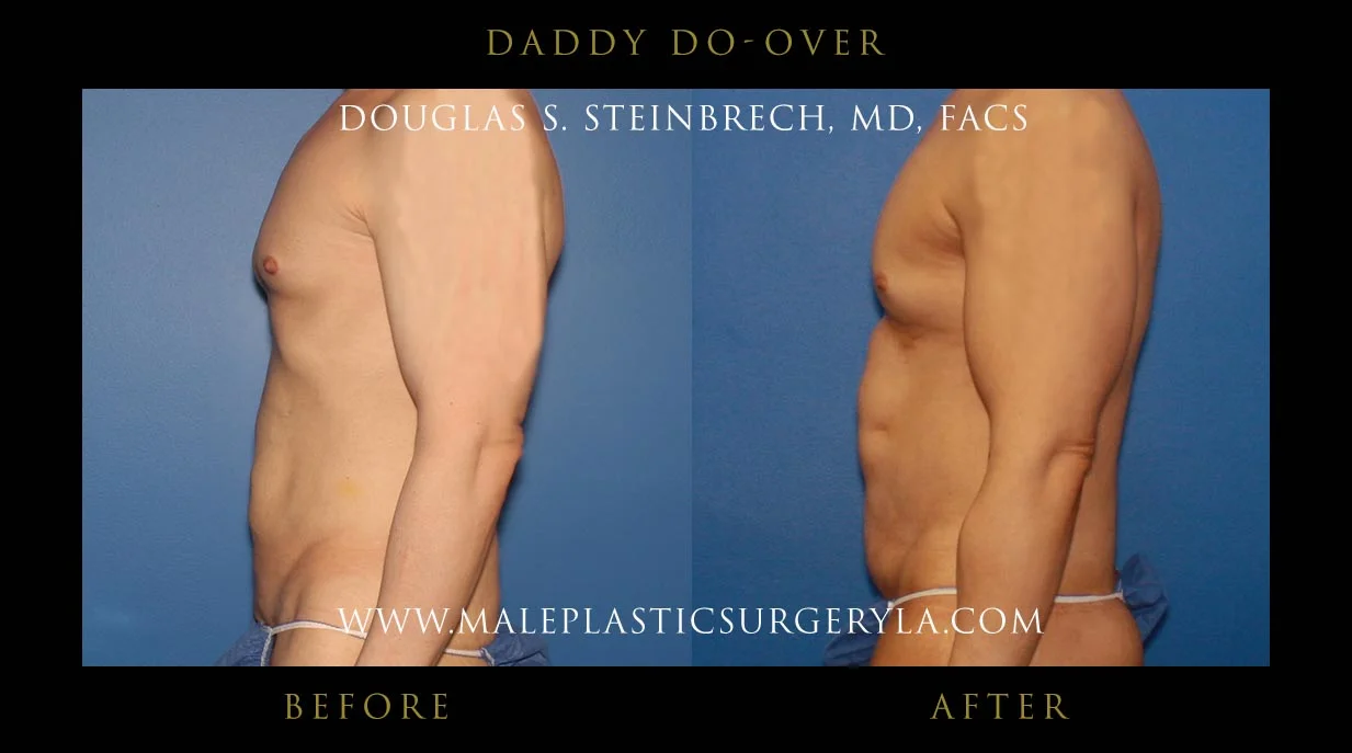 Daddy Do Over - Before & After Photos