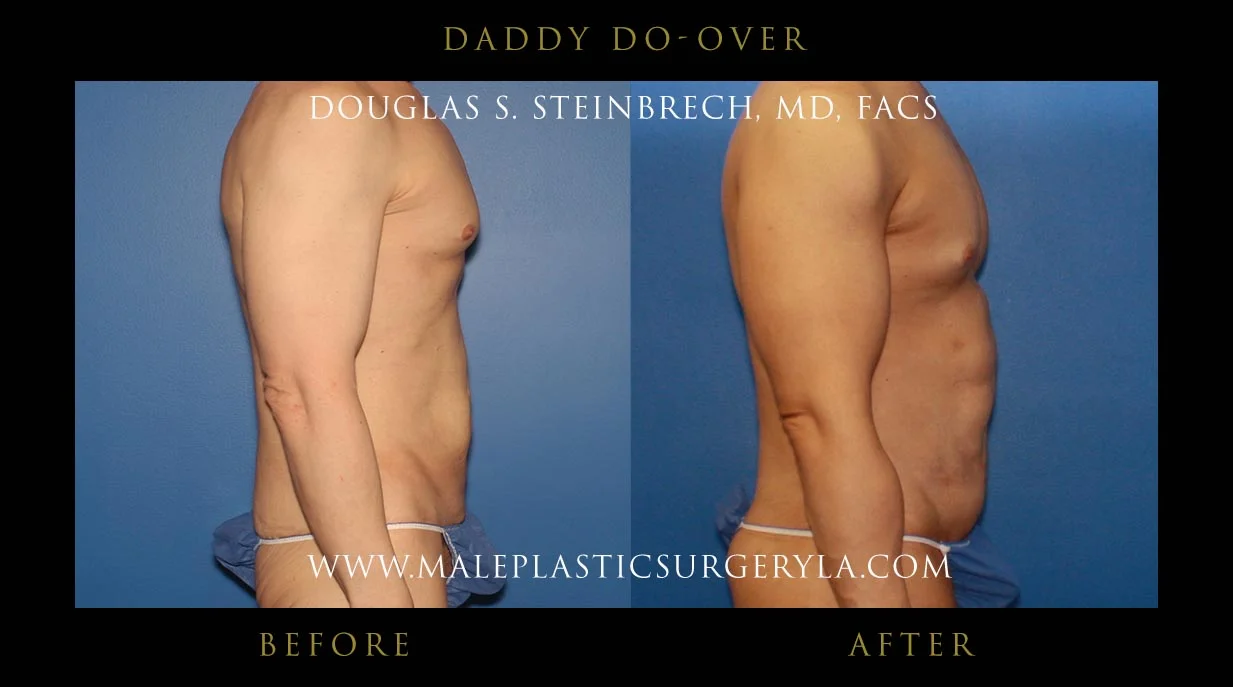 Daddy Do Over - Before & After Photos