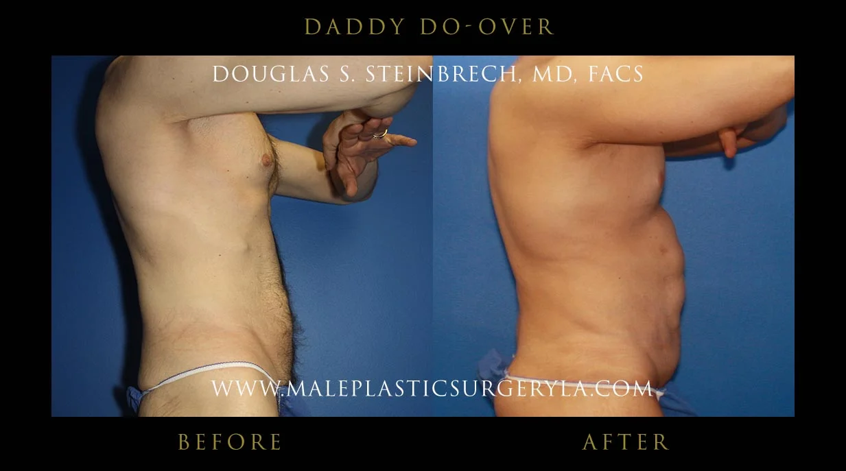 Daddy Do Over - Before & After Photos