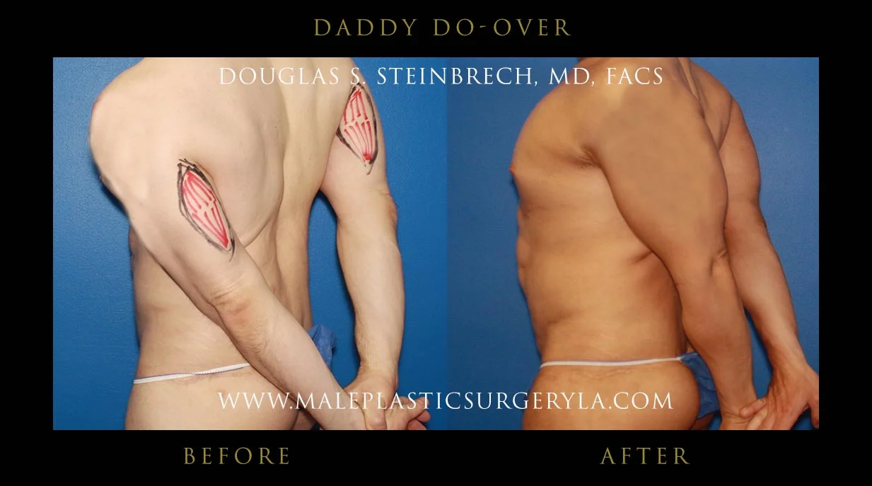 Daddy Do Over - Before & After Photos