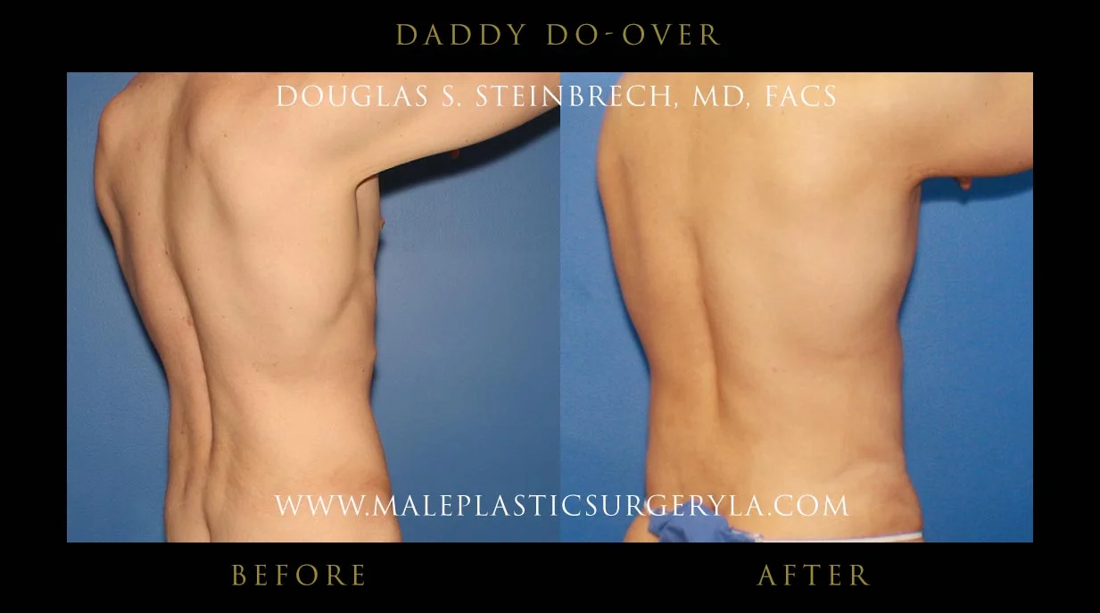 Daddy Do Over - Before & After Photos