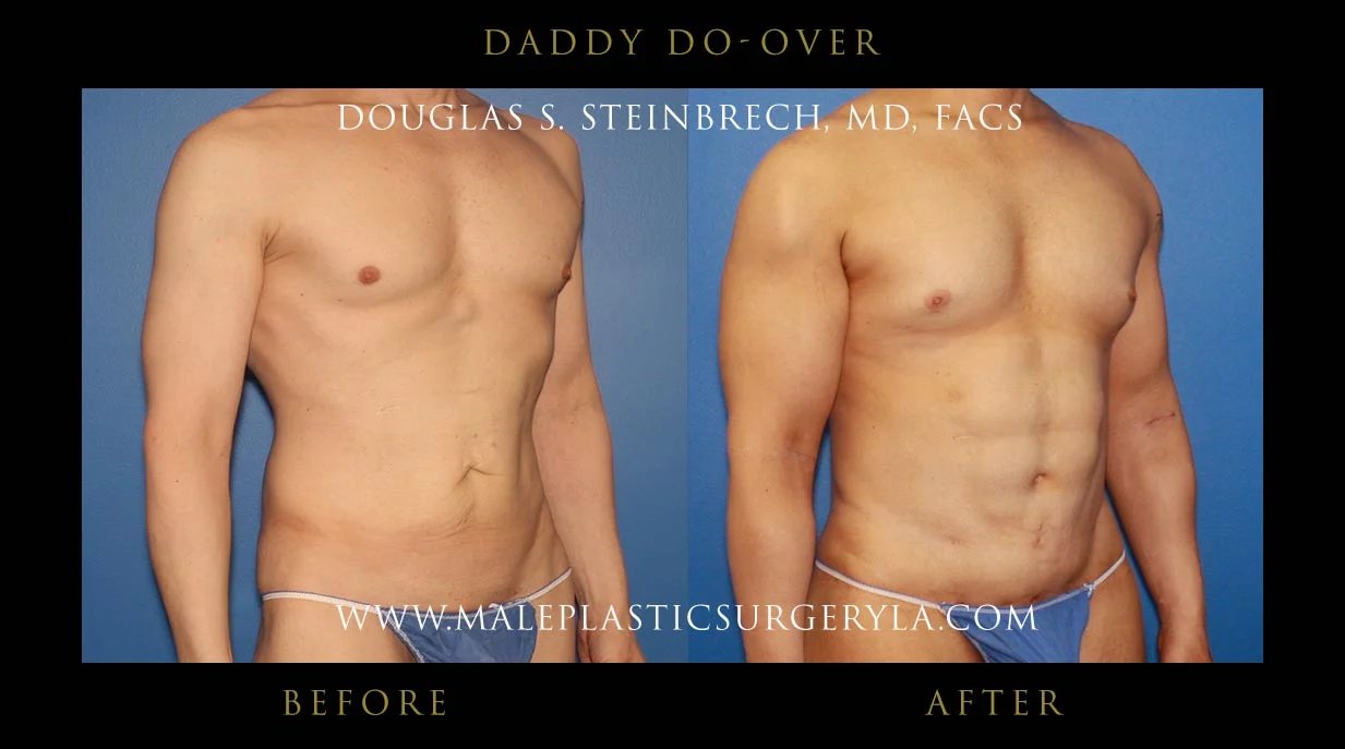 Daddy Do Over - Before & After Photos