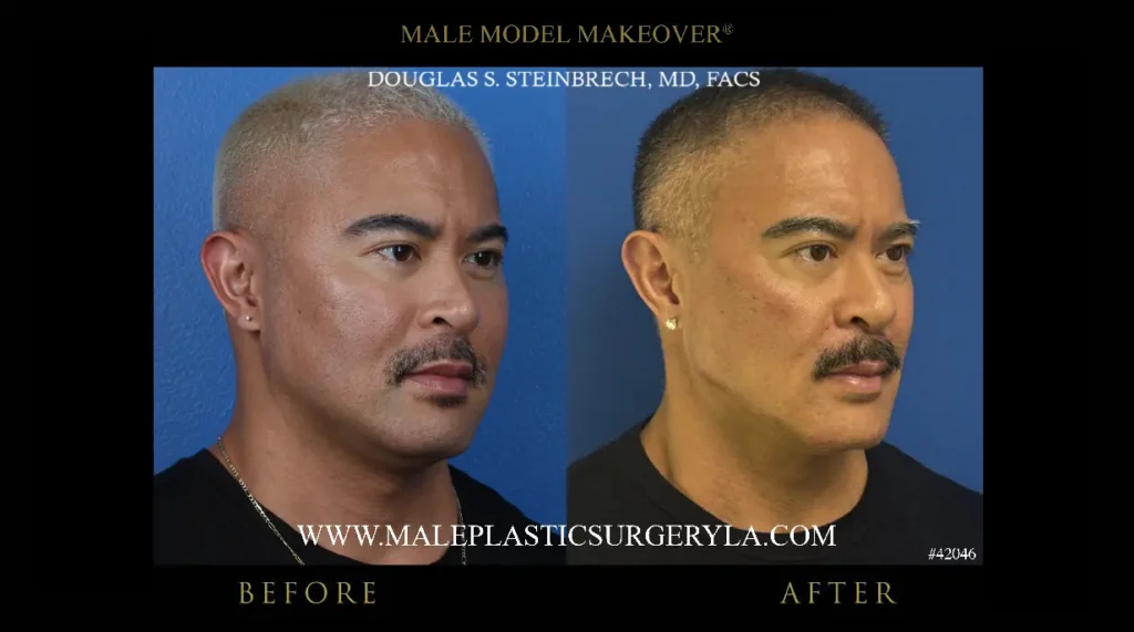 male-model-makeover-before-after-135-degree-la