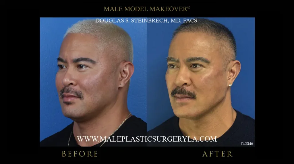 male-model-makeover-before-after-45-degree-la