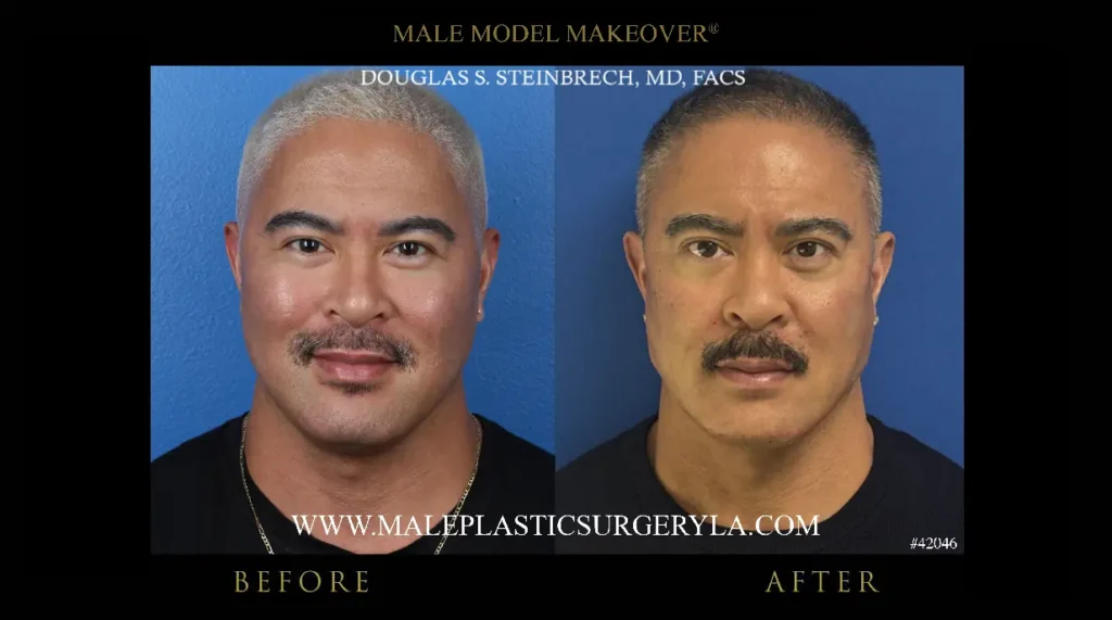 male-model-makeover-before-after-front-view-la