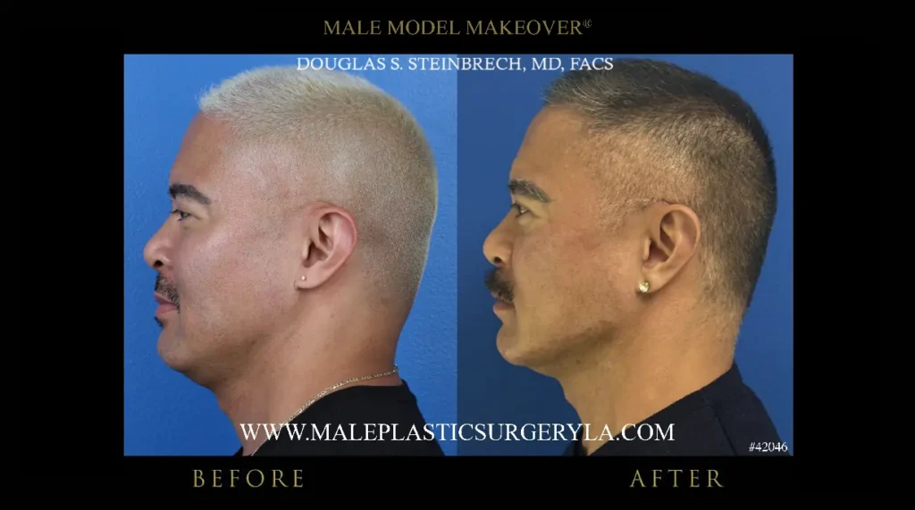 male-model-makeover-before-after-left-side-profile-la