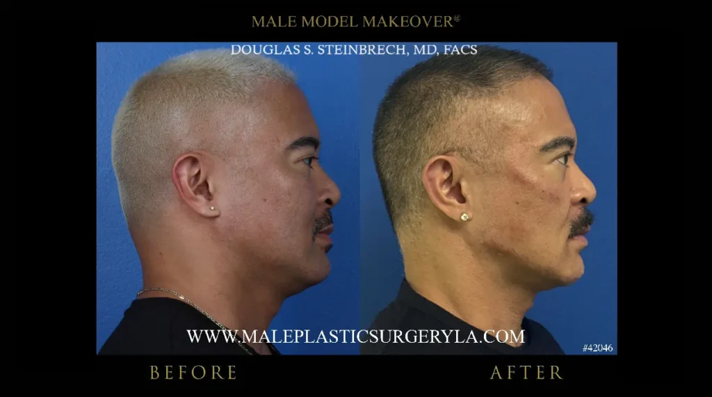 male-model-makeover-before-after-right-side-profile-la