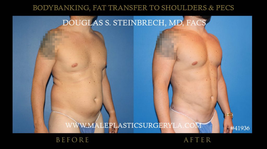 transform body changing results