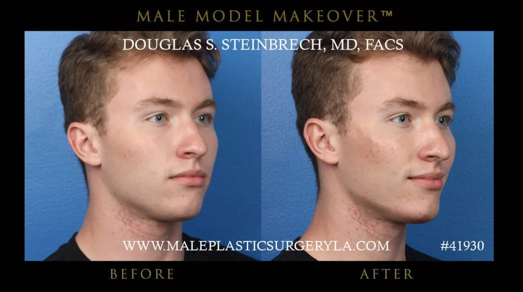 Male Model Makeover - Before & After Photos