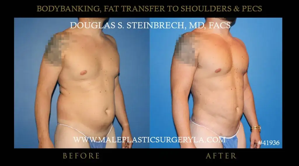 Body banking for men in LA, before and after photo -- right side