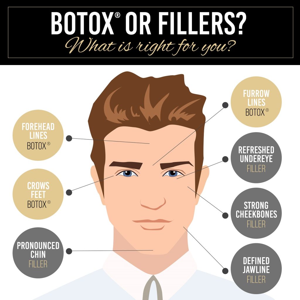 botox or fillers?