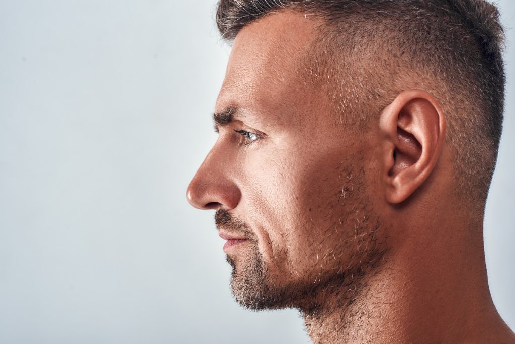 jawline filler for men los angeles